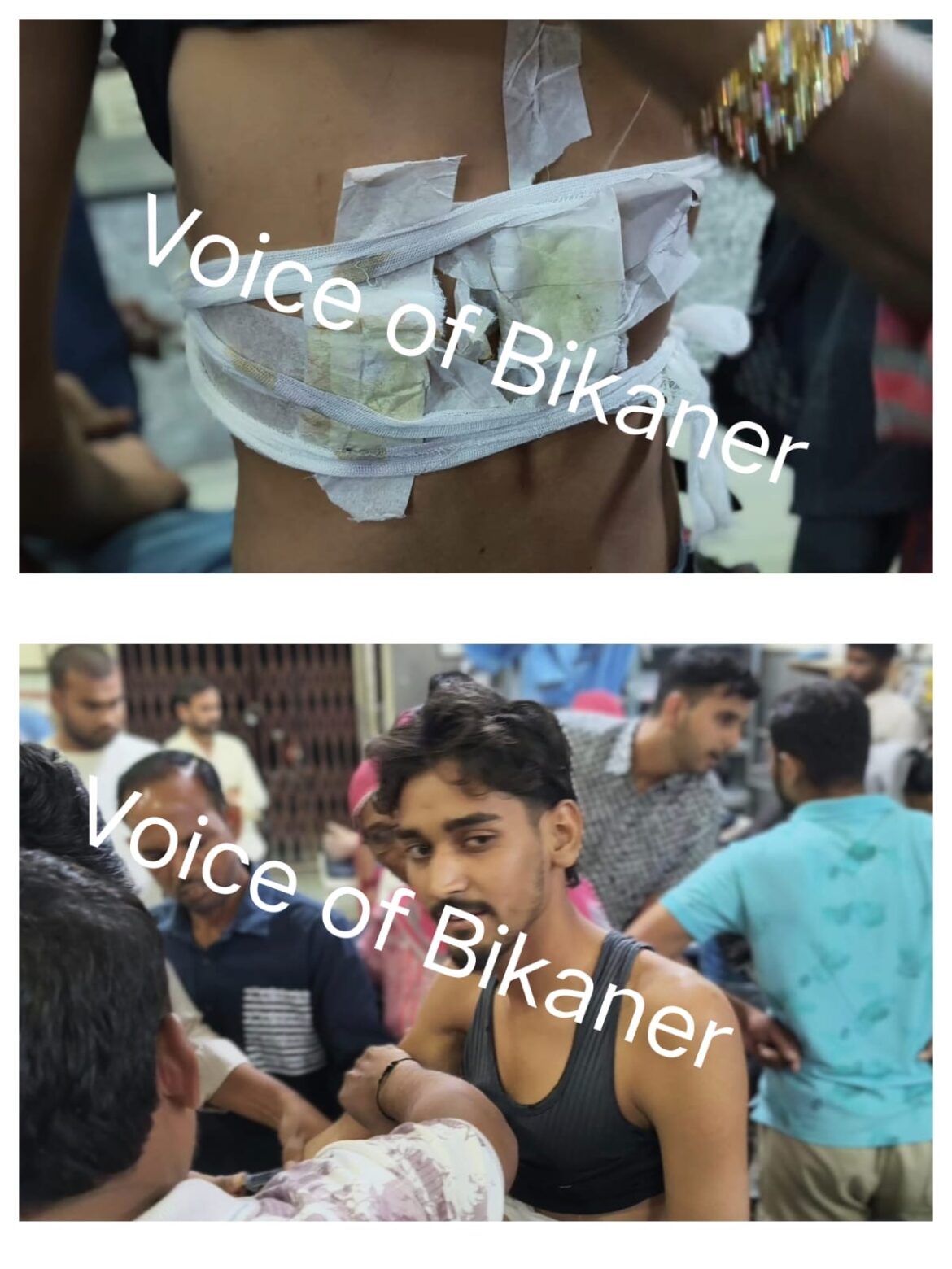 बीकानेर : मामूली बात पर चाकूबाजी, युवक की पीठ पर किए दो वार