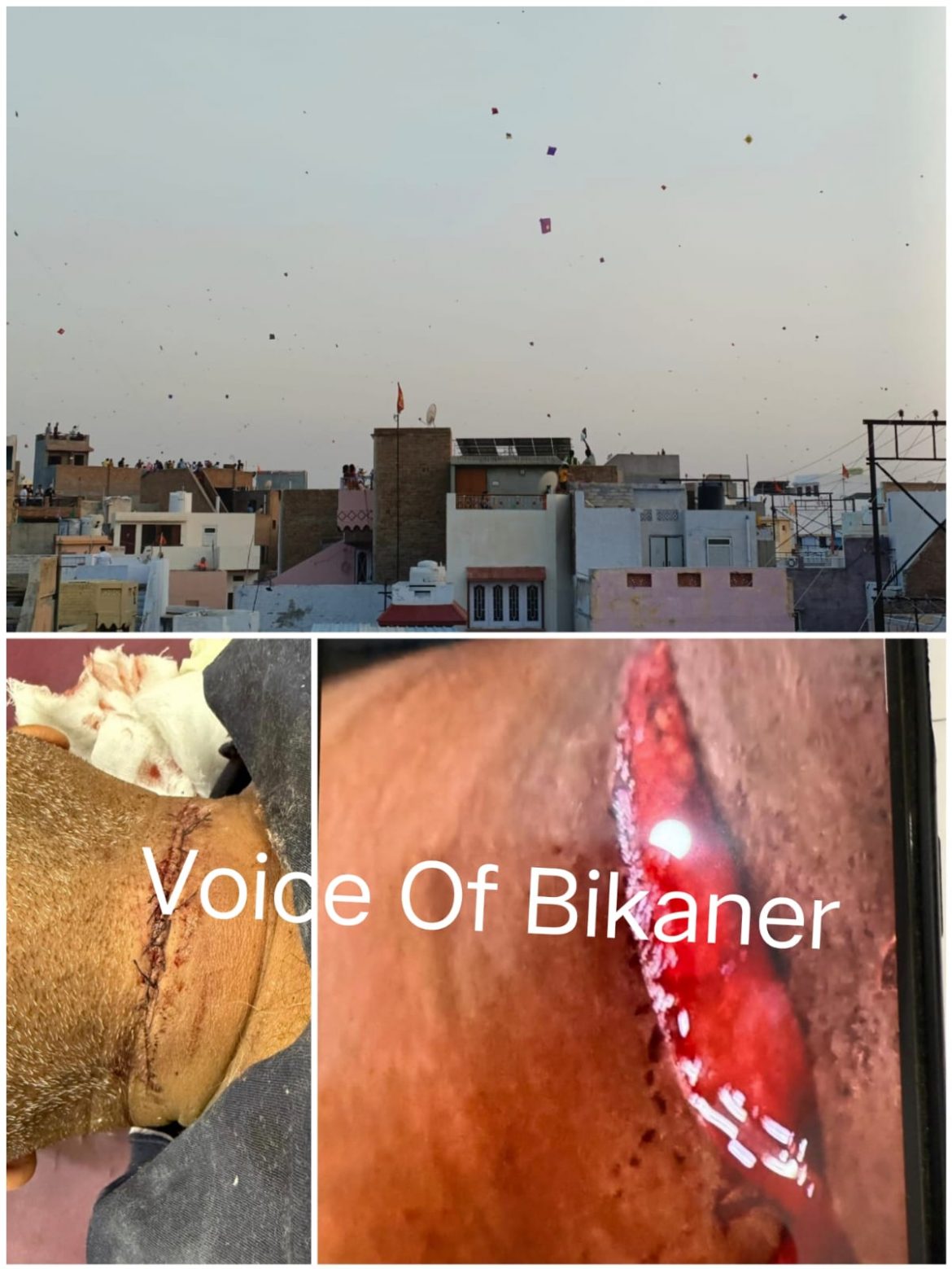 आखातीज पर बीकानेर में पतंगबाजी का जोश चरम पर, चायनीज मांझे ने बरपाया कहर – 20 से अधिक घायल, 7 की हालत गंभीर
