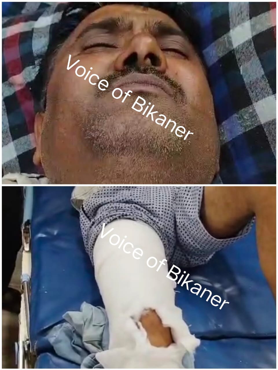 बीकानेर:जमीन विवाद को लेकर दो पक्षों में खूनी संघर्ष, सरपंच पति गंभीर रुप से घायल