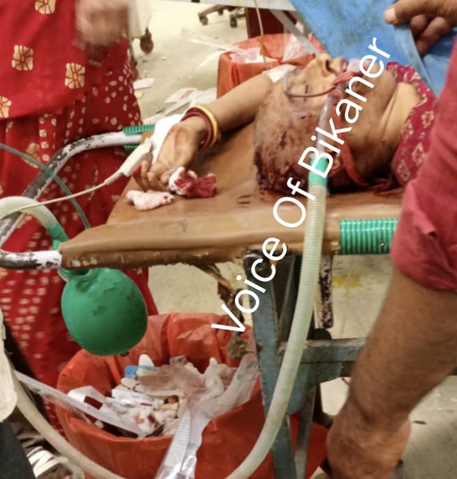 बीकानेर: करवा चौथ पर पति बना हैवान, पत्नी पर कुल्हाड़ी से ताबड़तोड़ वार, गंभीर हालत में महिला डीआईसीयू में भर्ती