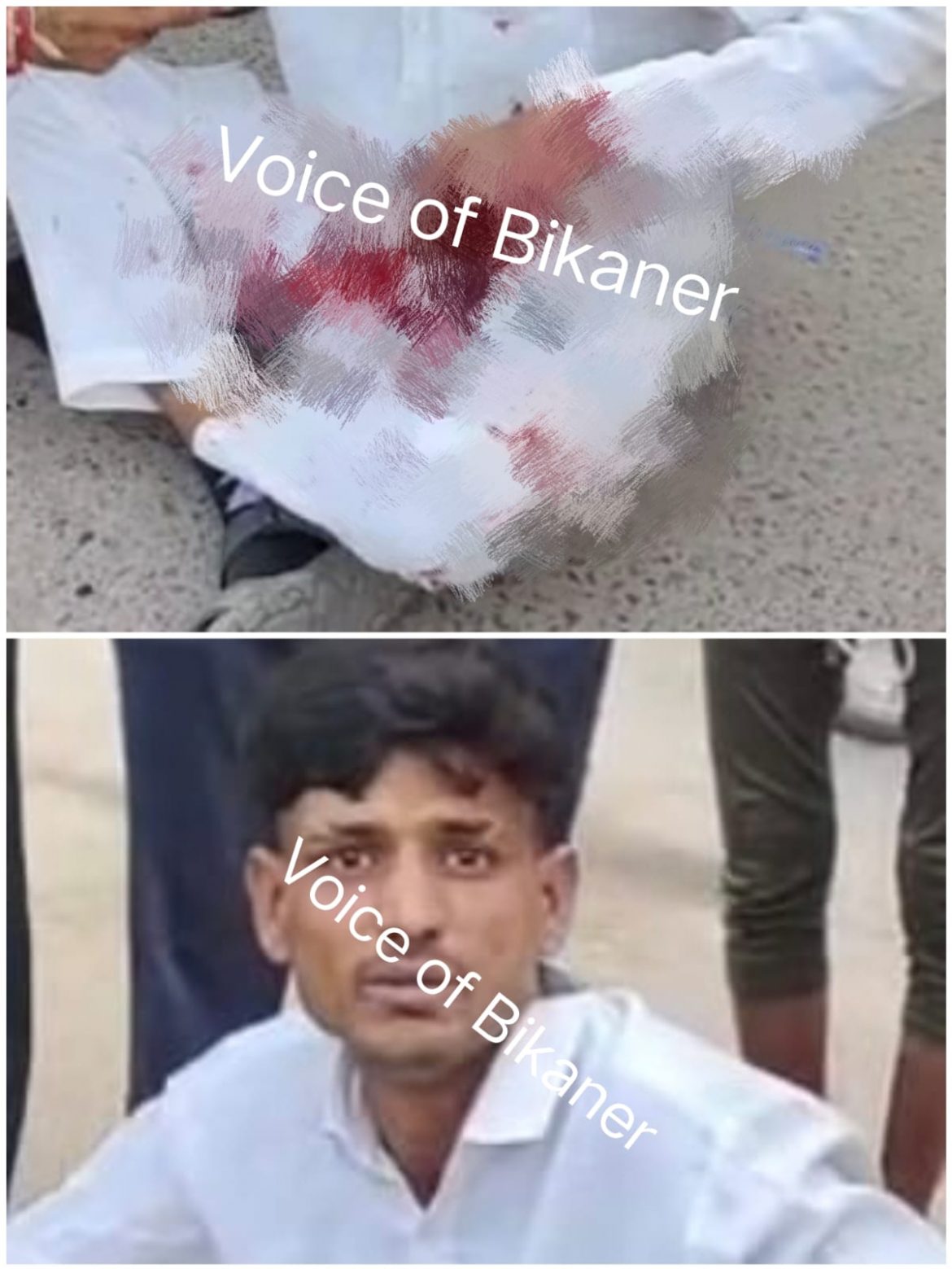 बीकानेर: कोटगेट इलाके में चाकूबाजी की वारदात,आपसी रंजिश बनी वजह