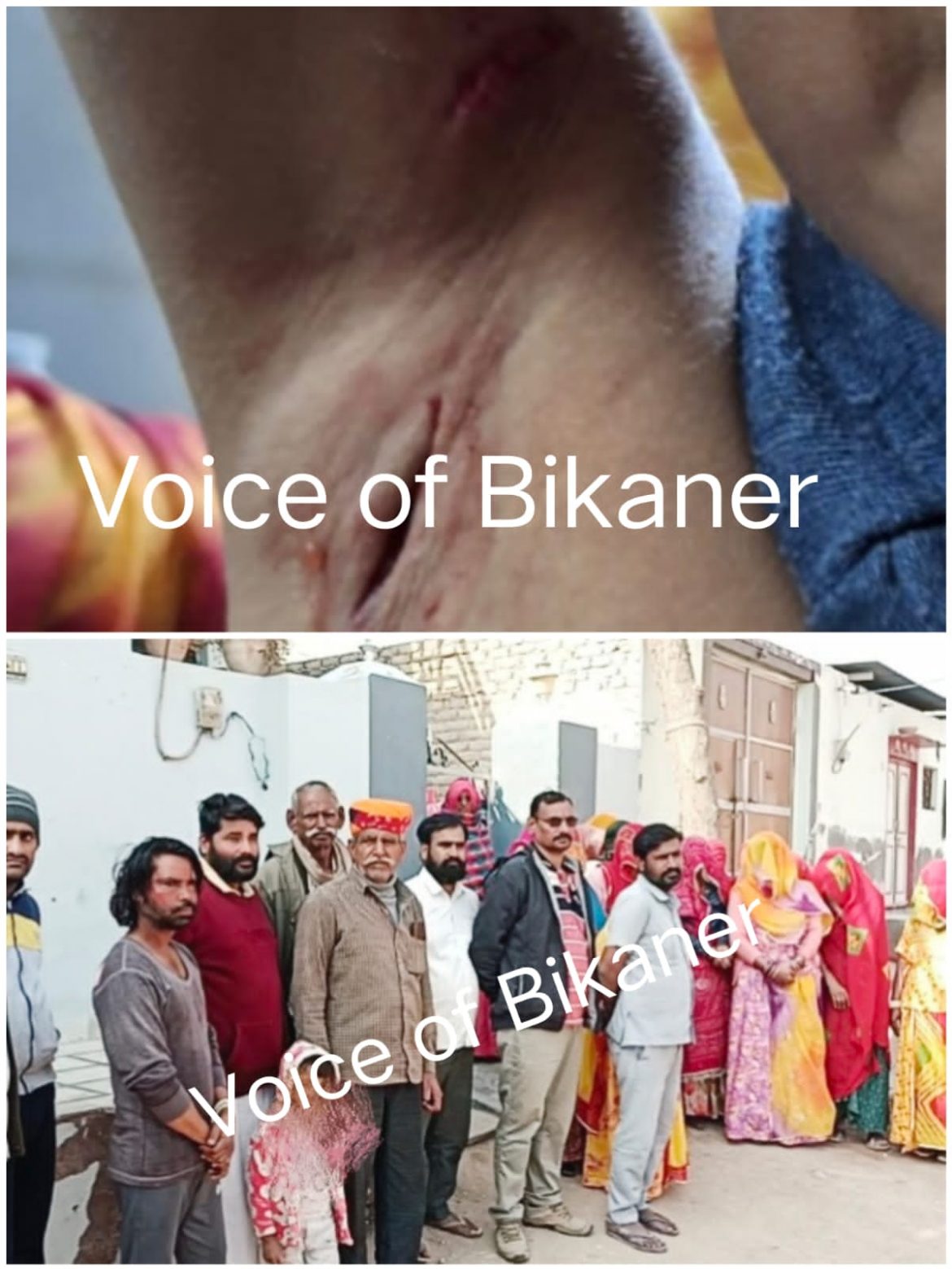 बीकानेर: पालतू कुत्तों के काटने से उबाल पर मोहल्ला,सोशल मीडिया इंफ्लूएंसर पर लगे गंभीर आरोप