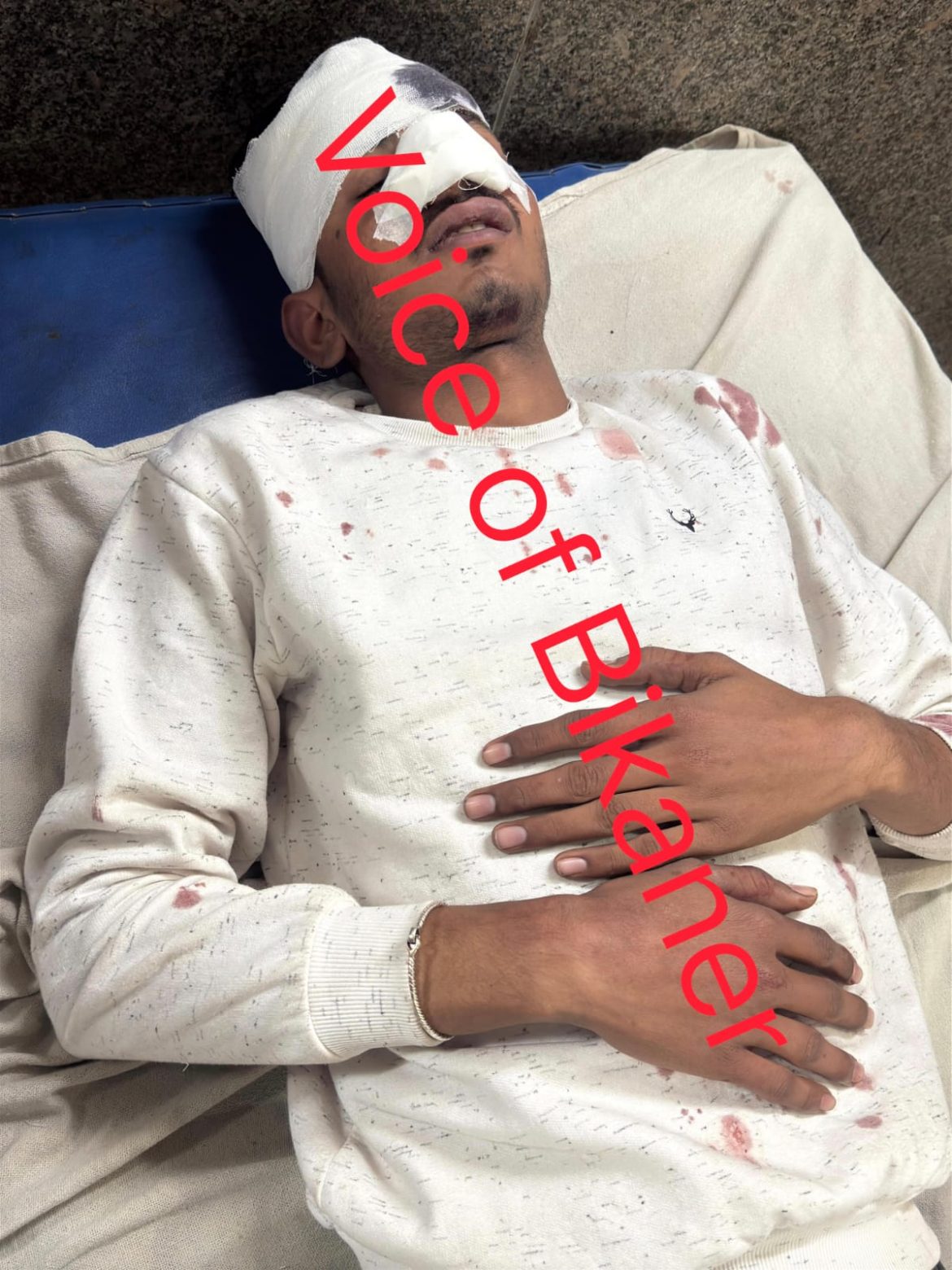 बीकानेर: देर रात युवक से बेरहमी से मारपीट ,दो युवक घायल, पुलिस जुटी जांच में