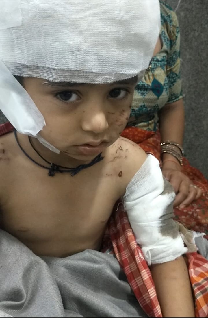 बीकानेर: स्कूल के पहले दिन मासूम को नोच खाया कुत्तों ने,लहूलुहान हालत में अस्पताल पहुंचा,हालत गंभीर