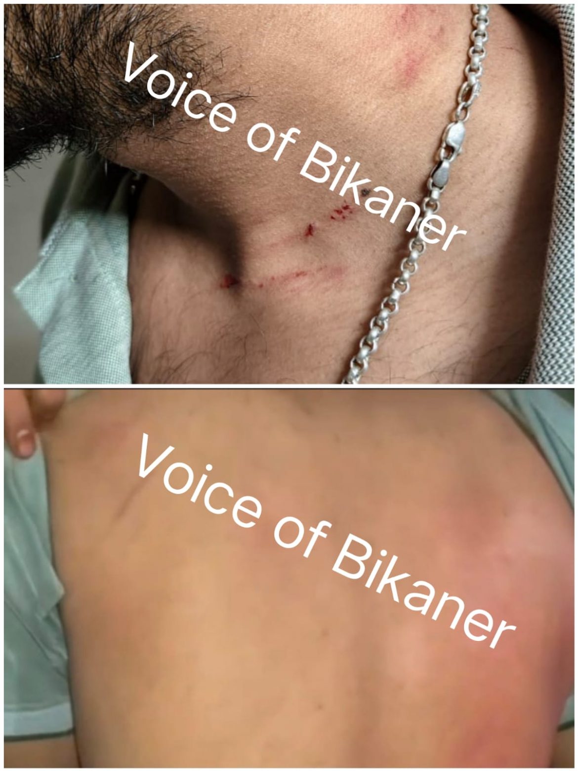 बीकानेर: कैफे संचालक से पुलिसकर्मियों की मारपीट का आरोप, रात को नयाशहर थाने के बाहर जुटे लोग