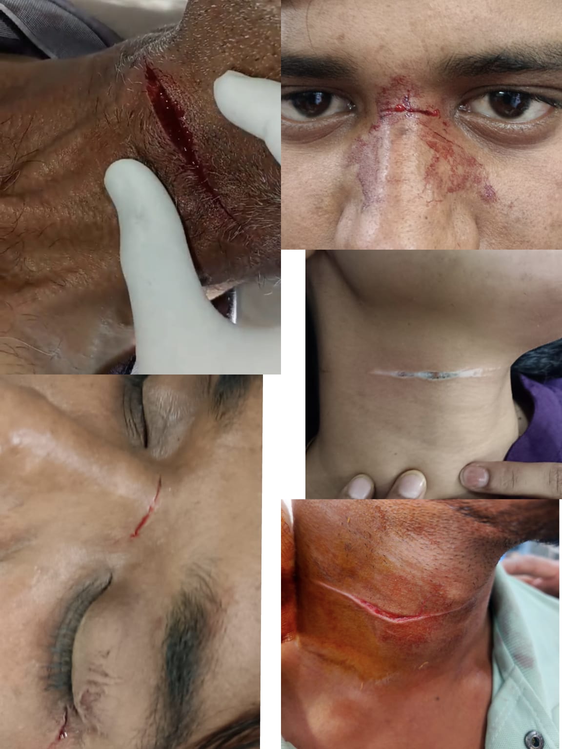 बीकानेर: प्रतिबंध के बावजूद खूब बिक रहा मौत का मांझा ,कातिल मांझे से 150 से ज्यादा लोग लहूलुहान