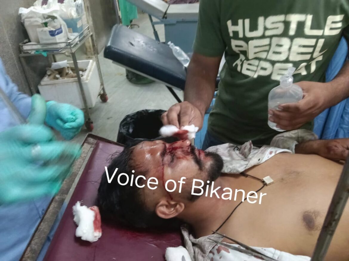 बीकानेर: आपसी रंजिश के चलते युवक पर जानलेवा हमला, लोहे की रॉड व लाठी-डंडों से की मारपीट