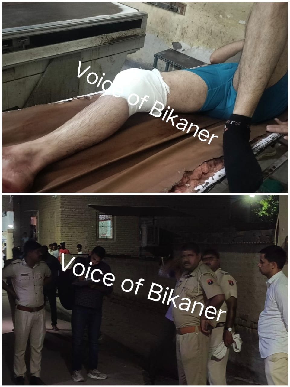 बीकानेर: लेनदेन विवाद में युवक पर फायरिंग, रोहित गोदारा गैंग का नाम लेकर दी धमकी