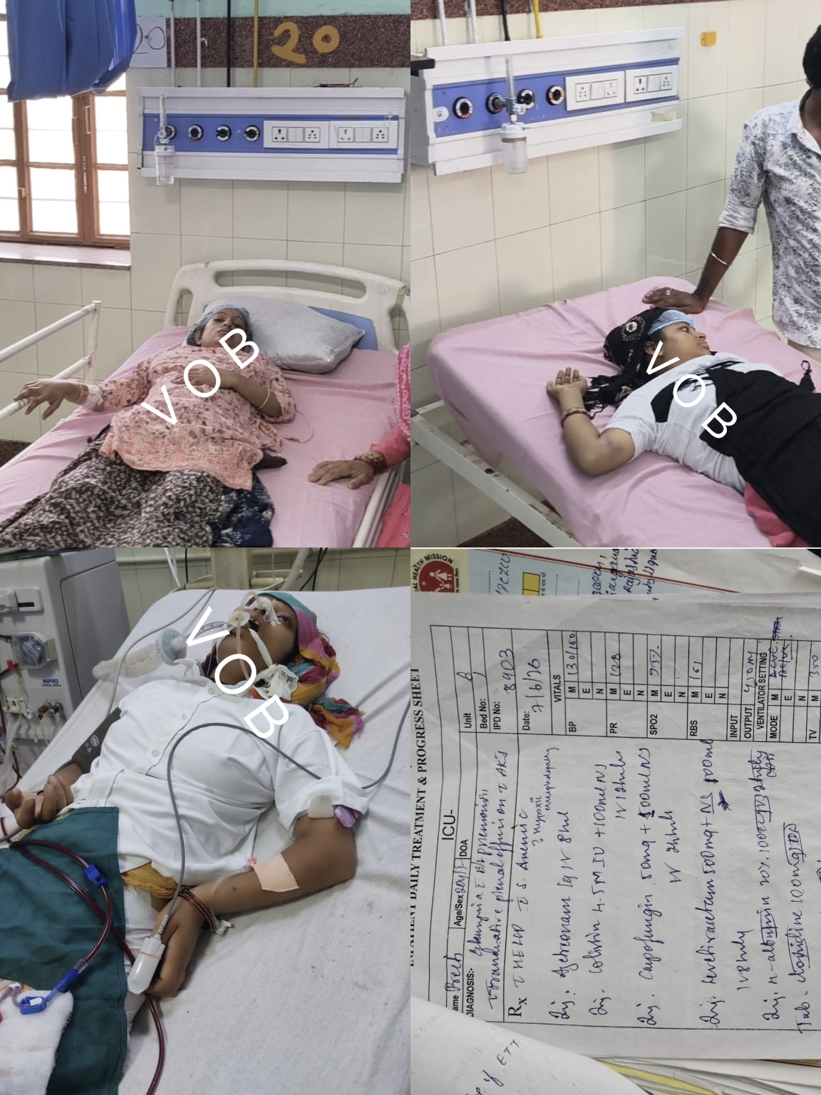बीकानेर: वेंटिलेटर पर सिस्टम! मां बनने की खुशी के बीच मौत का साया,पीबीएम अस्पताल में 6 प्रसूताएं डायलिसिस पर, एक वेंटिलेटर पर