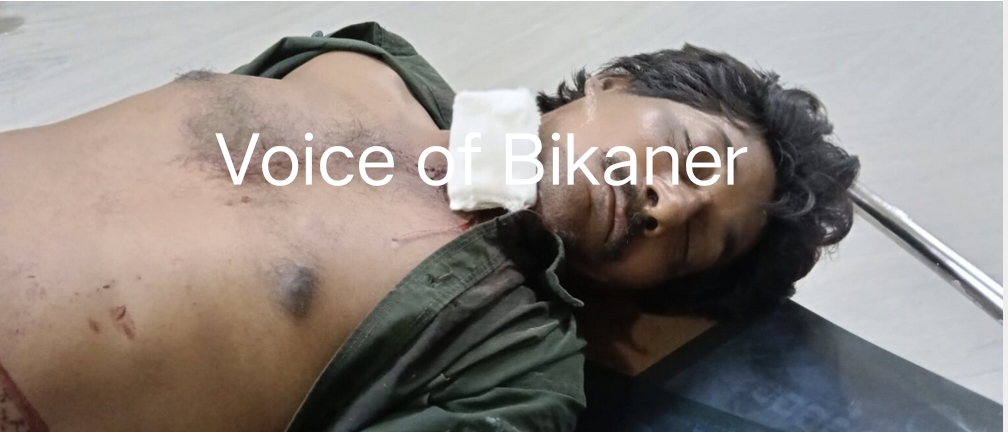 बीकानेर: पत्नी के चाकू के वार से पति गंभीर घायल, पीबीएम में भर्ती