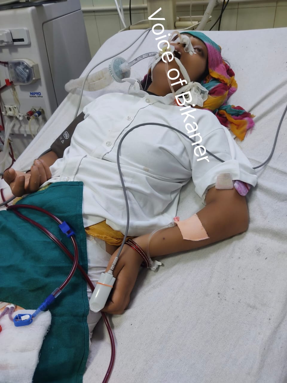 बीकानेर: पीबीएम में भर्ती गंभीर प्रसूता प्रीति की मौत, मल्टीपल ऑर्गन फेल्योर बना कारण