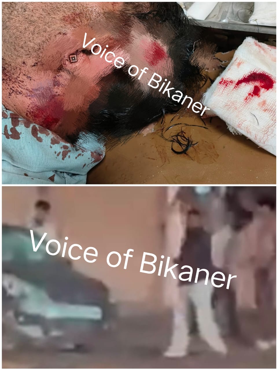 बीकानेर: गजनेर रोड ओवरब्रिज पर खूनी हमला, कार सवार चार युवकों पर ताबड़तोड़ वार, एक की हालत गंभीर
