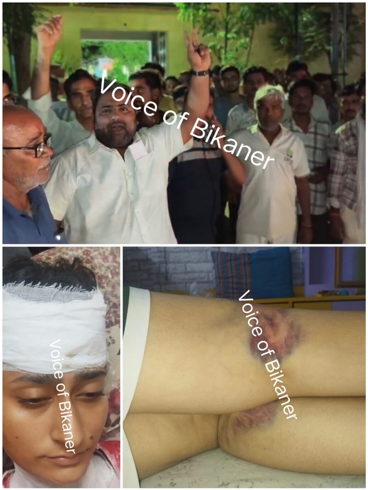 बीकानेर: मिर्च पाउडर फेंककर दो बहनों की लाठी डंडों से पिटाई, आरोपियों की गिरफ्तारी की मांग को लेकर सुथार समाज का थाने पर प्रदर्शन