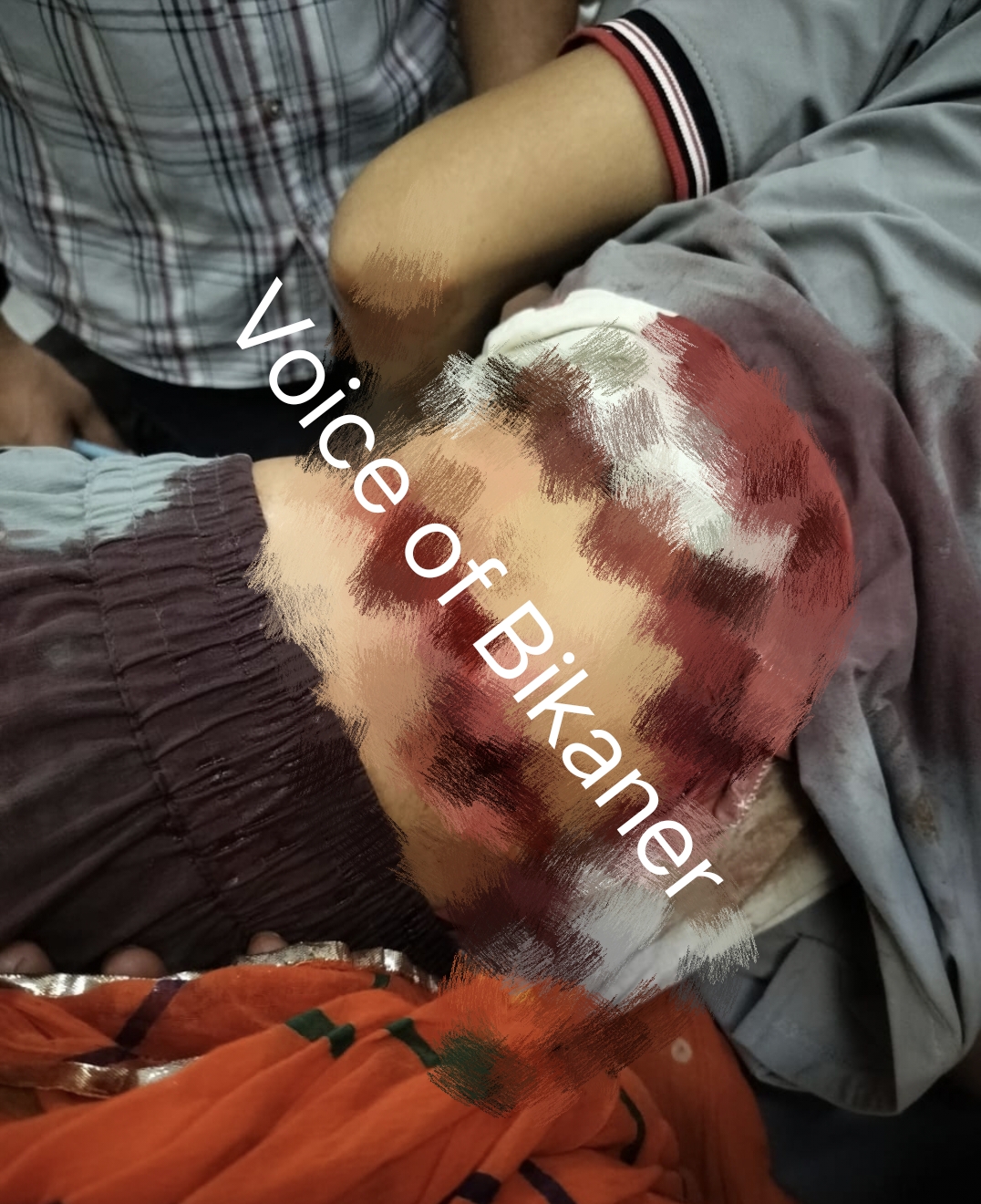 बीकानेर: पुरानी रंजिश ने लिया हिंसक रूप,कमर में चाकू लगने से युवक गंभीर रूप से घायल,हालत नाज़ुक
